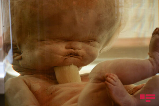 Alim: "Tək yaralı yerimiz meyit azlığıdır" - FOTO