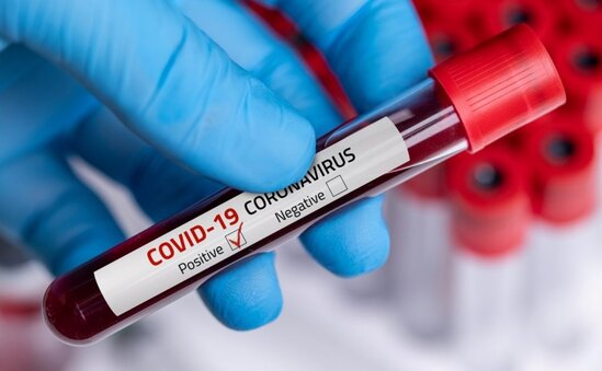 Yoluxma sayı 50-yə çatır