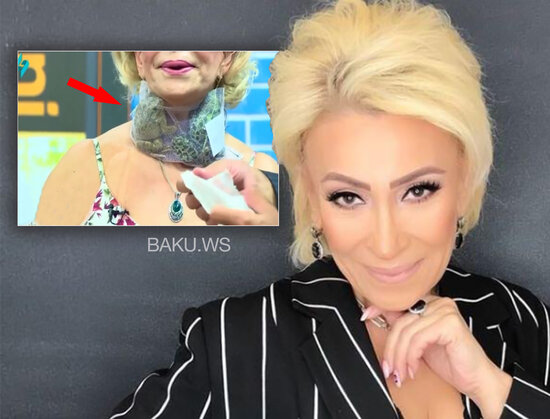 Əməkdar artistin boğazına qurbağa bağladılar - VİDEO