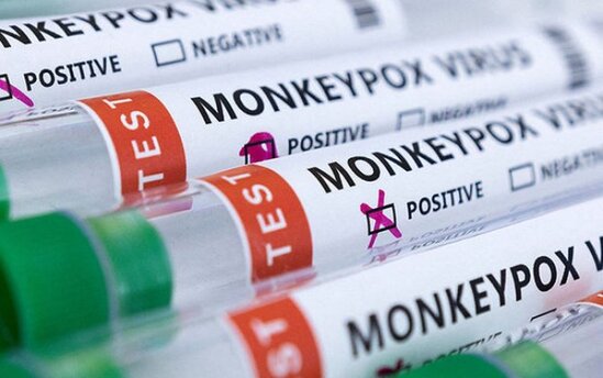 Britaniya alimləri meymunçiçəyinin "ədəbsiz" əlamətlərini açıqlayıblar