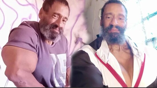 Daha böyük əzələlər üçün özünə yağ iynəsi vurdu: "TikTok" ulduzunun acı sonu