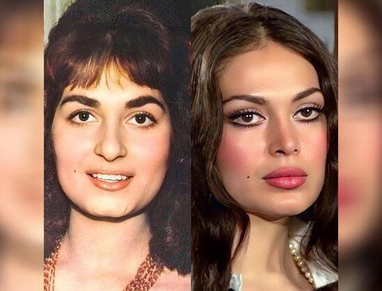 Türkan Şorayı dəyişdirən plastik əməliyyatlar və qiymətləri - FOTO