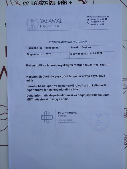 İki yaşlı Mirsəccadın başında şiş aşkarlanıb - FOTO