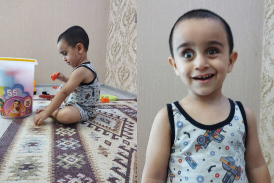 İki yaşlı Mirsəccadın başında şiş aşkarlanıb - FOTO