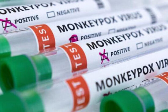 İki ölkədə meymunçiçəyindən ölümlər qeydə alınıb