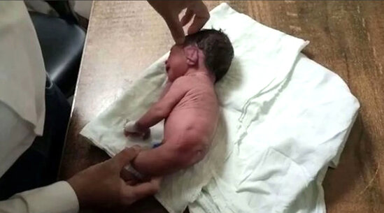 Yeni doğulan körpənin bədən quruluşu görənləri şoka saldı: Beldən aşağı... - FOTO