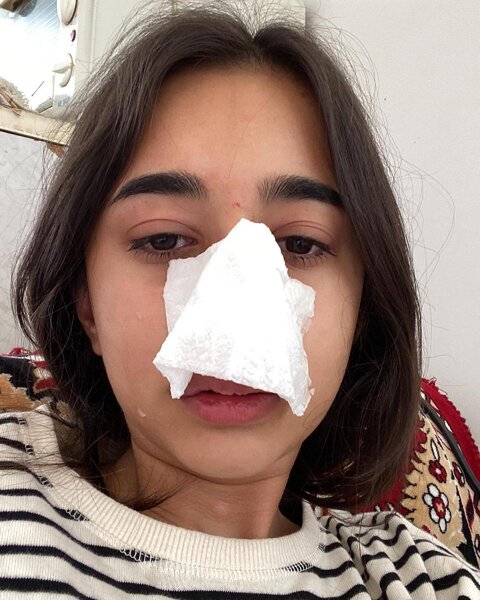 Sevgilisi azərbaycanlı blogeri döyüb - Fotolar