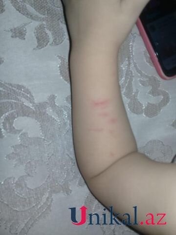 "Bir yaşlı uşağımı bağçada döyüblər" - İDDİA + FOTO