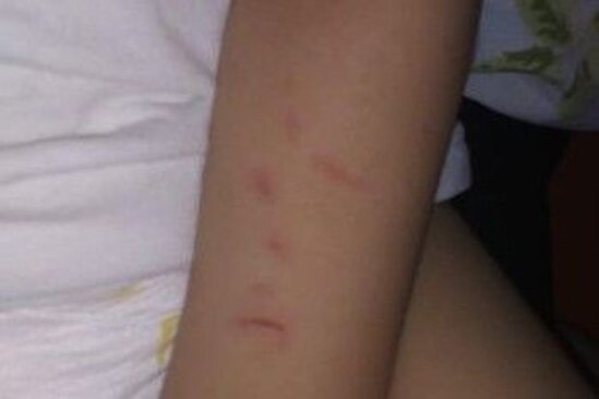 "Bir yaşlı uşağımı bağçada döyüblər" - İDDİA + FOTO