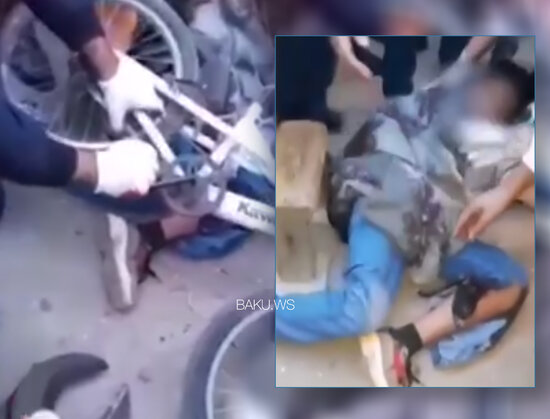Velosiped 12 yaşlı oğlanın ayağını kəsdi - VİDEO