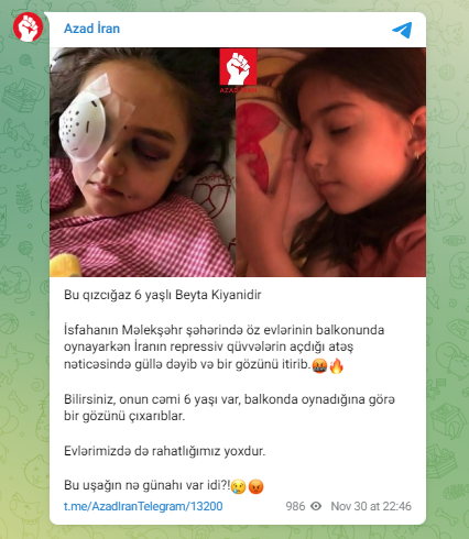 İranda hərbi-polis qüvvələri eyvanda oynayan uşağa atəş açıb, 6 yaşlı qız gözünü itirib - FOTO