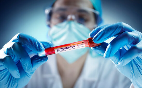 Son sutkada 3 nəfər virusa yoluxdu