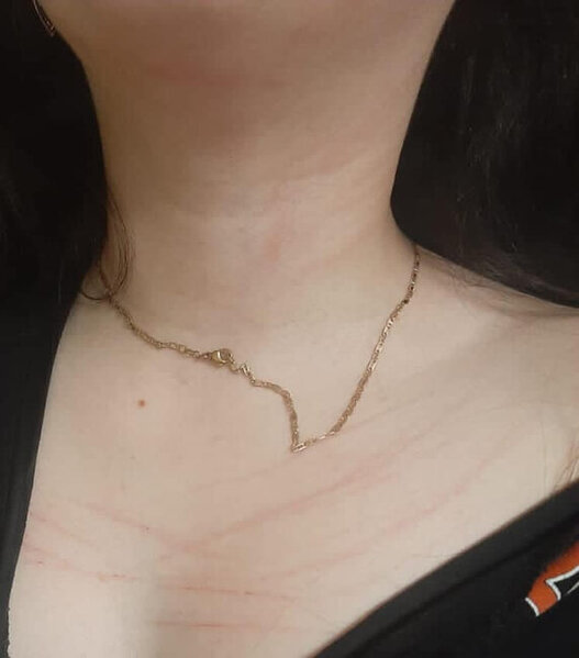 Küçədə qaçırılan qadınla bağlı ŞOK DETALLAR - Gələn gündən şiddət görür - FOTO - YENİLƏNİB