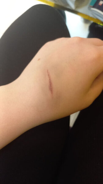 Küçədə qaçırılan qadınla bağlı ŞOK DETALLAR - Gələn gündən şiddət görür - FOTO - YENİLƏNİB