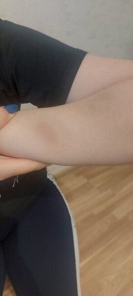 Küçədə qaçırılan qadınla bağlı ŞOK DETALLAR - Gələn gündən şiddət görür - FOTO - YENİLƏNİB