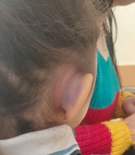 Yeddi yaşlı qız dəfələrlə şiddətə məruz qalıb - FOTO