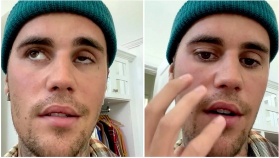 Xəstəliyi irəliləyən Castindən üzücü xəbər - FOTO