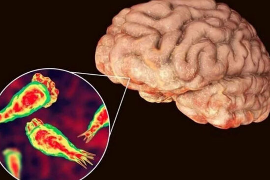 ABŞ-də "beyin yeyən amöb" can aldı - FOTO