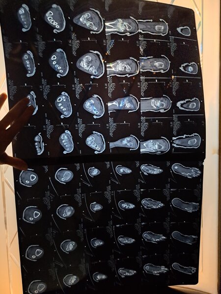 "İnternational Medical Center" TİBB Mərkəzinin həkimi xəstənin ayağını sındıracağı ilə hədələdi - VİDEO - FOTO