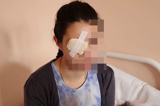 Evə taksi ilə gəldiyi üçün döyülən qadın: "Uşaqlar gözümü necə çıxardığını gördülər"