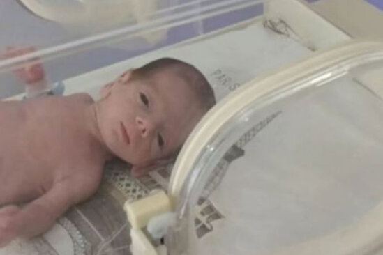 Azərbaycanda 845 qramlıq körpə doğuldu - VİDEO