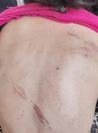 Saatlıda hamilə qadını ailəsi ilə danışmaq istədiyinə görə döyüblər - YENİLƏNİB - FOTO