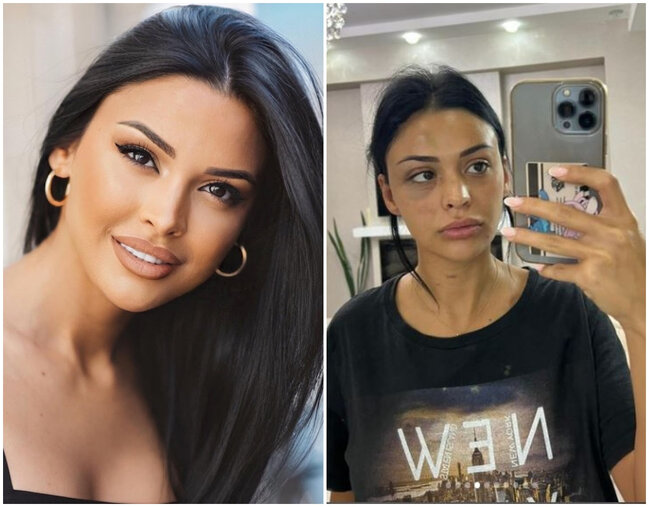 Sevgilisi tərəfindən döyülən Razi: "Məni 13-cü mərtbədən aşağı atmaq istədi" - FOTO