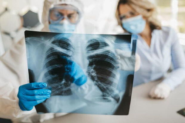 Ötən il Azərbaycanda qeydə alınan yeni vərəm xəstələrinin sayı AÇIQLANDI