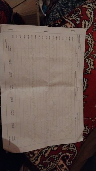 Balaca Tuncayın eşitməsi üçün dəstəyə ehtiyacı var: "3 000 manatımız çatmır" - FOTO