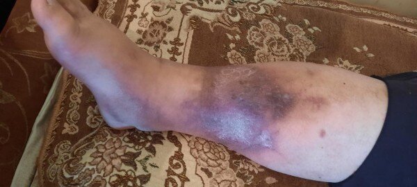 "Beynəlxalq Bank" qazinin pulunu mənimsəyib - ŞİKAYƏT