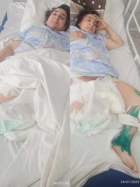 Nərimanov Tibb Mərkəzi xəstəni ölümdən belə xilas etdi - FOTO