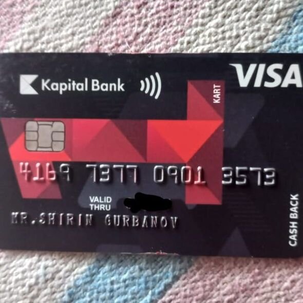 Üç dəfə əməliyyat keçirmiş Aytənin yardıma ehtiyacı var - FOTO