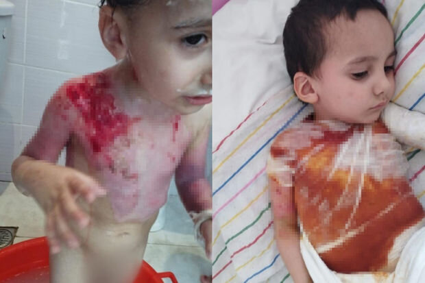 Dəhşətli faciə ilə üzləşən iki azyaşlı qardaşın yardımınıza ehtiyacı var - FOTO