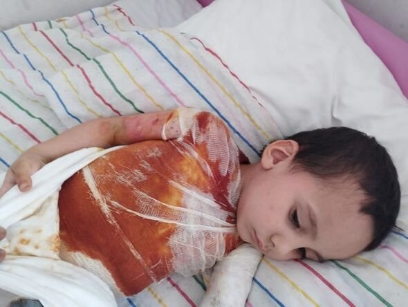 Dəhşətli faciə ilə üzləşən iki azyaşlı qardaşın yardımınıza ehtiyacı var - FOTO