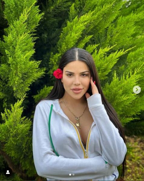 Bədəni çürüyən azərbaycanlı modeldən YENİ AÇIQLAMA - FOTO