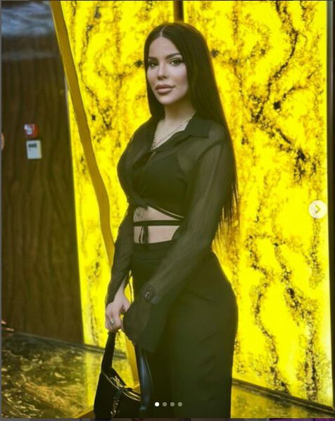 Bədəni çürüyən azərbaycanlı modeldən YENİ AÇIQLAMA - FOTO