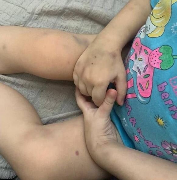 4 yaşlı Sunayın atası dəstək gözləyir: "Mən tək bu ağır yükün altından çıxa bilmərəm" - FOTO