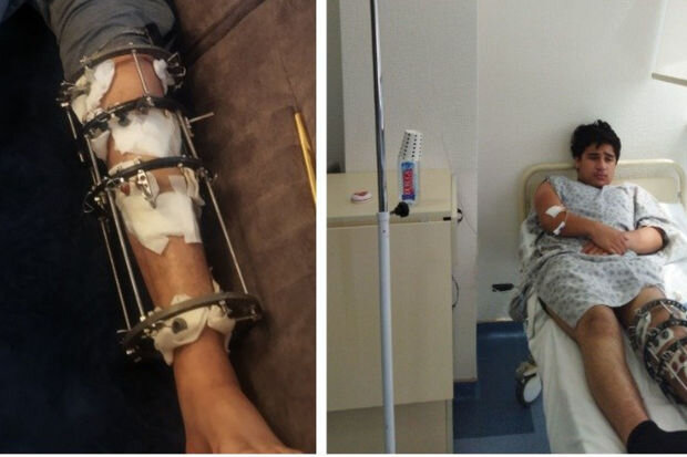 Oğlum 11 əməliyyat keçirib və hazırda bahalı müalicəyə ehtiyacı var - YARDIM ÇAĞIRIŞI - FOTO