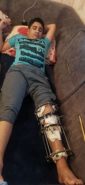 Oğlum 11 əməliyyat keçirib və hazırda bahalı müalicəyə ehtiyacı var - YARDIM ÇAĞIRIŞI - FOTO