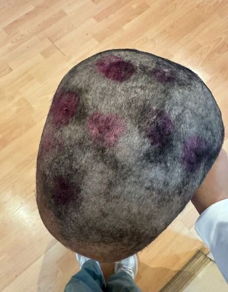 Bakıda dəhşət: Bacılara valideynləri tərəfindən işgəncə verilib - FOTO