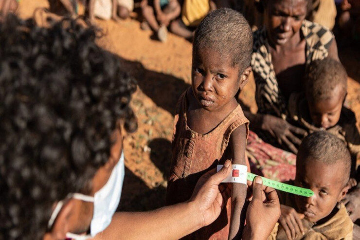 Dünyadakı ac insanları sayı rekord həddə çatdı