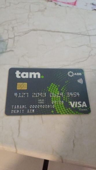 Beş yaşlı Yusifin həyatda qalması üçün dəstəyə ehtiyacı var - FOTO