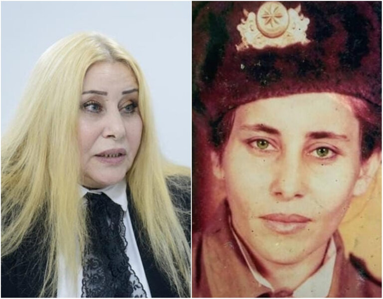 100-dən çox qəlpə yarası alan Xalq artisti: "Üzümə 27 tikiş vurulub" - VİDEO