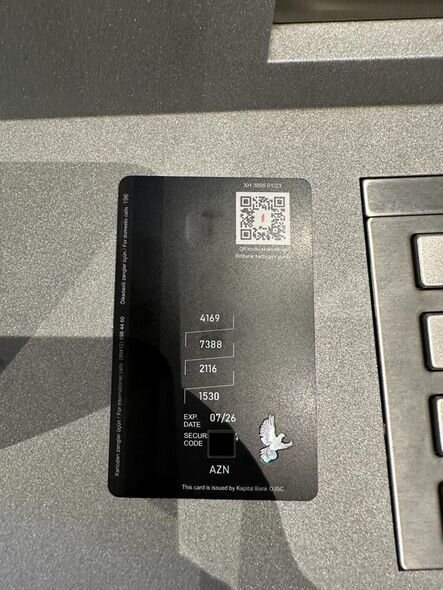 Bədəni yanan 2 yaşlı Ayanın dəstəyə ehtiyacı var: İmkan olmadığı üçün müalicə yarımçıq qalıb - FOTO