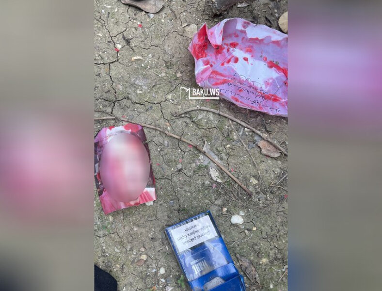 Xırdalan qəbiristanlığında cadu - Qanlı şəkilləri kim atır? – FOTO