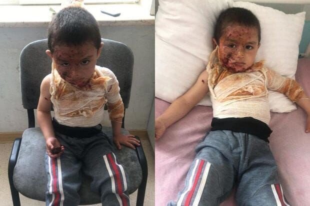 Dörd yaşlı Rəvanın müalicəsi üçün 500 manata ehtiyacı var - FOTO