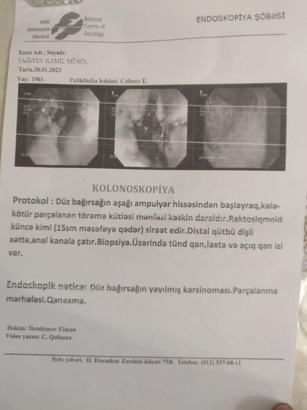 Xərçənglə mübarizə aparan şəxsin köməyə ehtiyacı var: "Ən böyük arzum hər iki balamın toyunu görməkdir" - FOTO