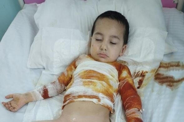 Oyun oynayarkən yanan iki azyaşlı qardaşın köməyinizə ehtiyacları var - FOTO