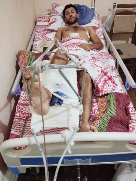 21 yaşlı Adil ağır qəzaya düşüb: Təcili əməliyyat olunmalıdır - FOTO/VİDEO