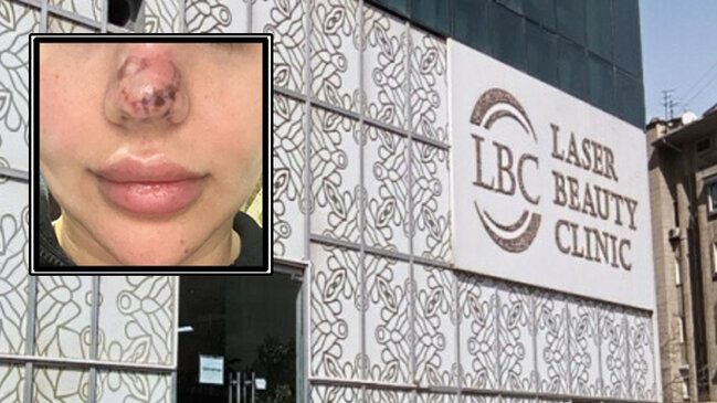 Rəna Soltanovanın daha bir qurbanı danışdı: "İşimdən oldum, külli miqdarda pul itirdim"